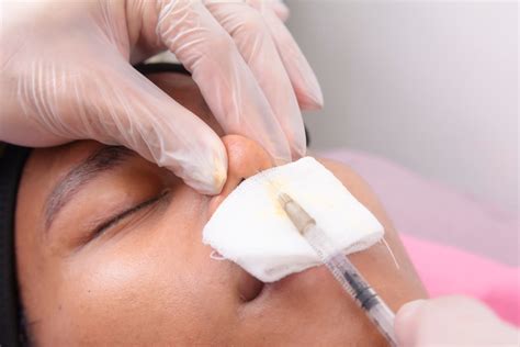 Cultural Identity Is Taking Center Stage In Rhinoplasty And Surgeons Are Listening Medesthetics Cultural Identity Is Taking Center Stage In Rhinoplasty And Surgeons Are Listening Medesthetics