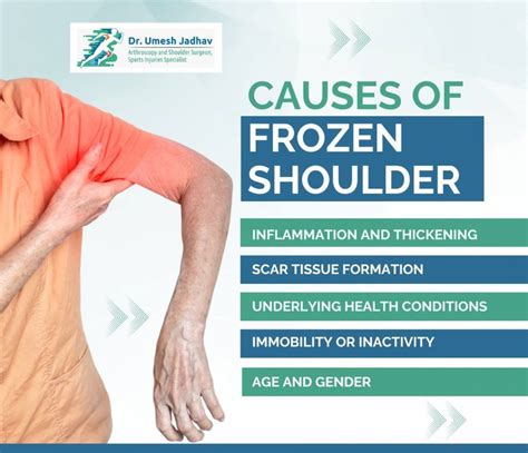 Discovering The Best For Pain Relief What Is The Most Effective Treatment For Frozen Shoulder Sunnyvale Sports Medicine And Orthopedic Center Discovering The Best For Pain Relief What Is The Most Effective Treatment For Frozen Shoulder Sunnyvale Sports Medicine And Orthopedic Center