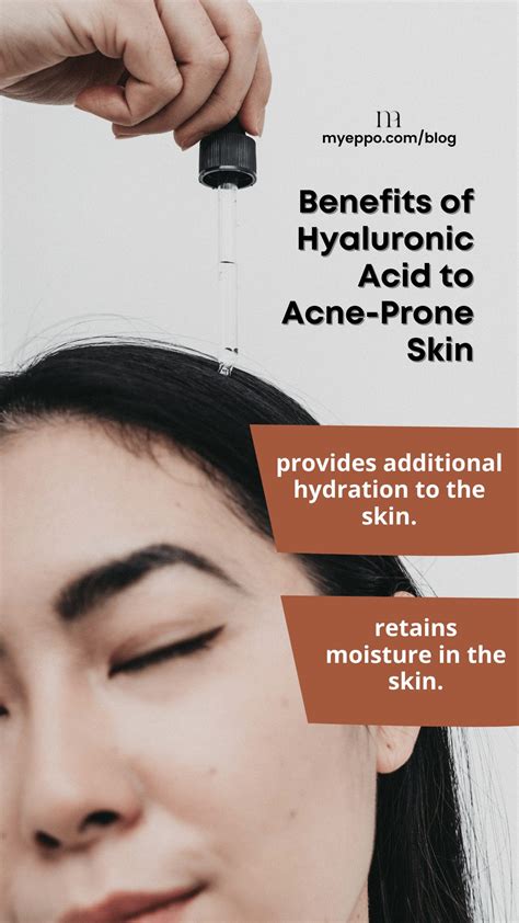Like A Rainstorm In A Desert: Does Hyaluronic Acid Help Acne