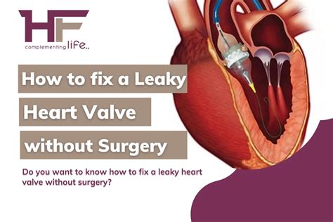 Leaking Heart Valve: Causes and Treatments