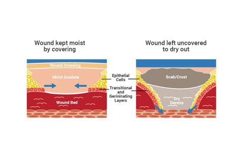 Bbq Pitmasters: Moist Smoking Vs Dry For Tender, Juicy Meat Results