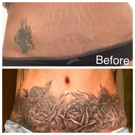 Tattoo Over Stretch Marks 7 Creative Designs To Consider Tattoo Over Stretch Marks 7 Creative Designs To Consider