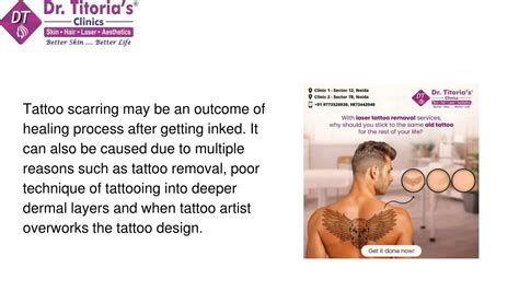 Tattoo Scarring Can I Treat Or Remove Unwanted Tattoo Scars Tattoo Scarring Can I Treat Or Remove Unwanted Tattoo Scars